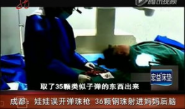 天天射视频,揭秘热门短视频平台的魅力与争议